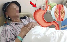 Duy trì 1 thói quen, người đàn ông 53 tuổi phát hiện ung thư từ rất sớm