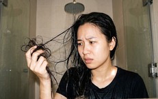 Rụng tóc bao nhiêu khi gội đầu là bình thường? 5 cách hạn chế rụng tóc