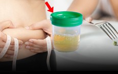 Nhịn ăn giảm cân, người phụ nữ 30 tuổi phát hiện tiểu đường, nước tiểu đầy bọt