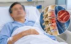 Cúm mãi không khỏi, người đàn ông 60 tuổi 'chết lặng' khi đi khám
