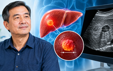 Người đàn ông không đau bụng, không vàng da vẫn phát hiện u gan gần 2 cm