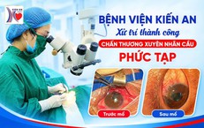Bảo tồn thị lực cho bệnh nhân bị mảnh bát vỡ đâm xuyên nhãn cầu