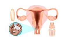 Vùng kín ngứa ngáy, đừng vội đặt thuốc nếu chưa biết điều này