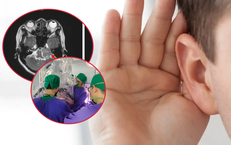 Đau đầu phát hiện khối u nằm ở vị trí nguy hiểm trong não 