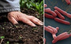 Bệnh Whitmore dễ bị bỏ sót do triệu chứng không điển hình