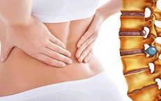 Nguy cơ thoát vị đĩa đệm do ngồi sai cách