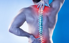 Thói quen xấu gây đau lưng, đau cổ nhiều người mắc phải