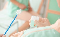 Các phương pháp phát hiện sớm ung thư cổ tử cung độ chính xác cao