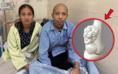 Cậu bé 16 tuổi mồ côi cha từ nhỏ phải cắt một phần chân vì ung thư