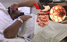 Mắc bệnh bí ẩn, nam doanh nhân 30 tuổi đi vệ sinh 100 lần/ngày, sụt 15kg