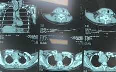 Chẩn đoán hình ảnh không cần phim in vào Quỹ BHYT chi trả