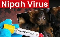 Bộ Y tế hướng dẫn chẩn đoán và điều trị bệnh truyền nhiễm do virus Nipah