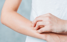 Bị dị ứng thời tiết nên làm gì?