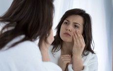 Sụp mí mắt ở người lớn: Cảnh báo sớm bệnh nhược cơ nguy hiểm