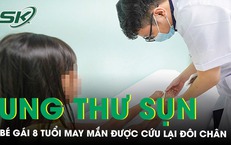 Cứu đôi chân bé gái 8 tuổi mắc ung thư sụn 