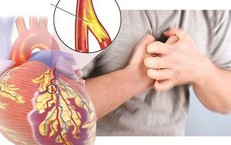 Lối sống thiếu lành mạnh, stress kéo dài khiến bệnh tim mạch dần trẻ hoá