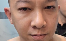 Triệt phá đường dây đánh bạc 900 tỷ đồng do Nguyễn Viết Duy cầm đầu