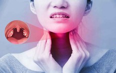 Viêm amidan tái phát có nên cắt không?