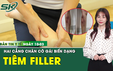 Bản Tin Y Tế 10/3: Tiêm filler để làm thẳng chân, cô gái 29 tuổi biến dạng cẳng chân