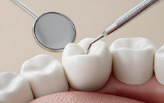 Vi phạm trong lĩnh vực y tế, 4 cơ sở nha khoa ở Lâm Đồng bị xử phạt 143 triệu đồng