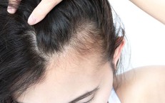 2 bước chăm sóc tóc mọc nhanh, dày