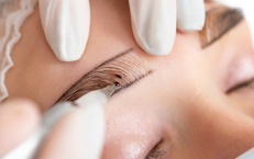 Từ 15/3, người làm dịch vụ phun xăm, tiêm filer phải đảm bảo các điều kiện nào để không vi phạm?