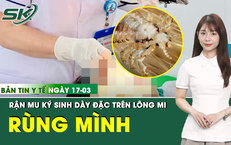 Bản tin Y tế 17/3: Rùng mình rận mu ký sinh dày đặc trên lông mi người phụ nữ 
