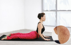 5 tư thế yoga đơn giản hỗ trợ làm mờ nám da tại nhà