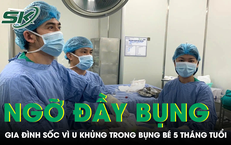 Chỉ nghĩ con bị đầy bụng, gia đình bất ngờ khi bé 5 tháng tuổi có khối u 'khổng lồ'