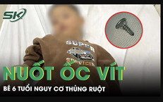 Nuốt ốc vít dài sắc nhọn, bé 6 tuổi nguy cơ thủng ruột