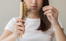 Sai lầm trong chăm sóc khiến rụng tóc nhiều người không nhận ra