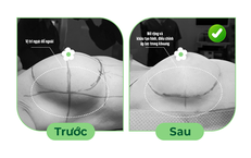Vỡ túi ngực sớm, nguyên nhân do đâu?