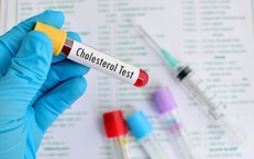 5 cập nhật mới về quản lý cholesterol không cần dùng thuốc