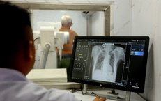 Phát hiện sớm để chặn nguồn lây bệnh lao trong cộng đồng