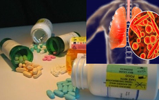 Lao kháng thuốc nguy hiểm thế nào?