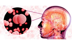 Viêm não mô cầu lây truyền như thế nào và dấu hiệu nhận biết đặc trưng