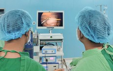 Nuốt tăm không hay biết, người đàn ông 58 tuổi bị thủng đại tràng