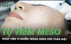Tự tiêm meso tại nhà, người phụ nữ nhập viện vì nhiễm trùng sưng phù toàn mặt