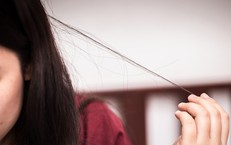 Tật giật, nhổ tóc gây tổn thương da đầu và sức khoẻ tinh thần như thế nào?