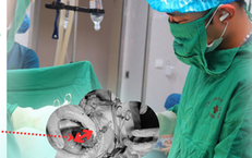 Giành lại sự sống cho bệnh nhân vỡ tử cung nguy kịch