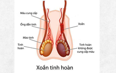 Nam sinh 14 tuổi phải cắt bỏ tinh hoàn do nhập viện muộn