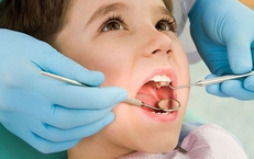 Trẻ sâu răng khi nào cần điều trị gây mê?