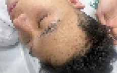 Công an Hà Nội điều tra vụ nam sinh bị nhóm đi ô tô ngược chiều chặn đầu, đánh hội đồng nhập viện