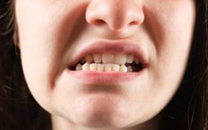 Lệch khớp cắn có gây bệnh lý răng miệng?