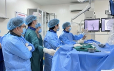 'Giải cứu' mắt lồi do rò động mạch cảnh xoang hang phức tạp bằng can thiệp nội mạch