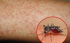 Nguy cơ dịch sốt xuất huyết gia tăng, Lâm Đồng yêu cầu tăng cường giám sát dịch