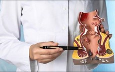 Trĩ xuất huyết: Đừng chủ quan với nguy cơ mất máu nghiêm trọng