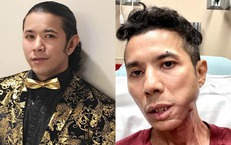 Kasim Hoàng Vũ qua đời sau thời gian bạo bệnh