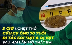 5 giờ nghẹt thở cứu cụ ông 70 tuổi bị tắc sỏi mật và dị vật sau hai lần mổ thất bại