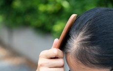 5 thói quen xấu khiến tóc bạc sớm ở người trẻ